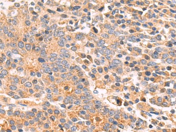 Anti-CD161 Rabbit Polyclonal Antibody