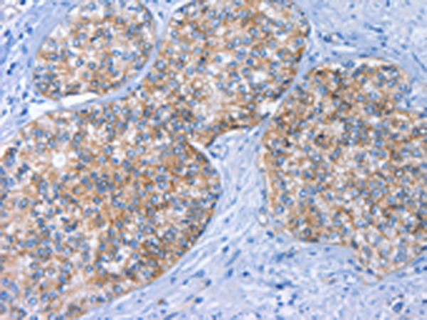 Anti-BCAM Rabbit Polyclonal Antibody