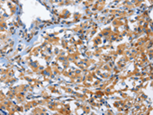 Anti-CD244 Rabbit Polyclonal Antibody