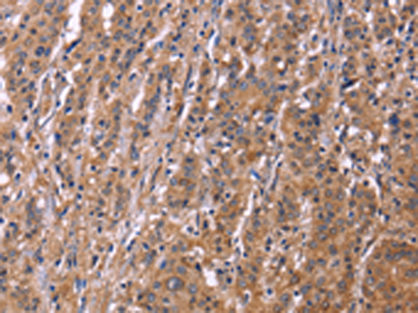 Anti-Septin 7 Rabbit Polyclonal Antibody