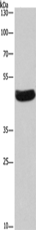 Anti-Septin 7 Rabbit Polyclonal Antibody