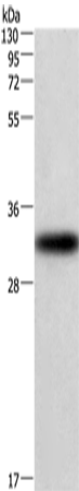Anti-CENPP Rabbit Polyclonal Antibody