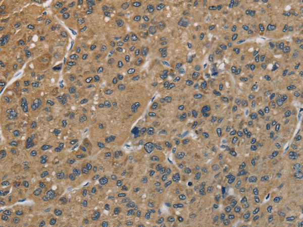 Anti-CENPN Rabbit Polyclonal Antibody