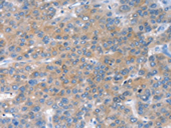 Anti-CHAC1 Rabbit Polyclonal Antibody
