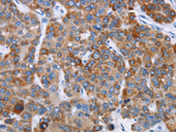 Anti-CHDH Rabbit Polyclonal Antibody