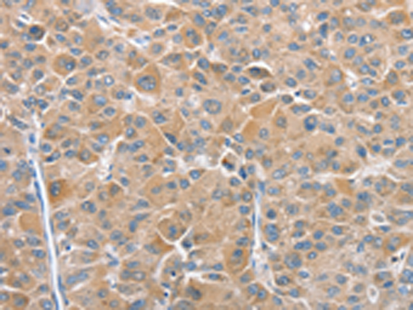 Anti-CHMP4B Rabbit Polyclonal Antibody