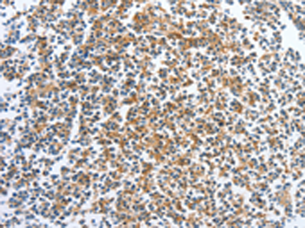 Anti-CKAP2 Rabbit Polyclonal Antibody