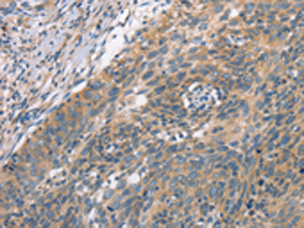 Anti-PLEKHO1 Rabbit Polyclonal Antibody