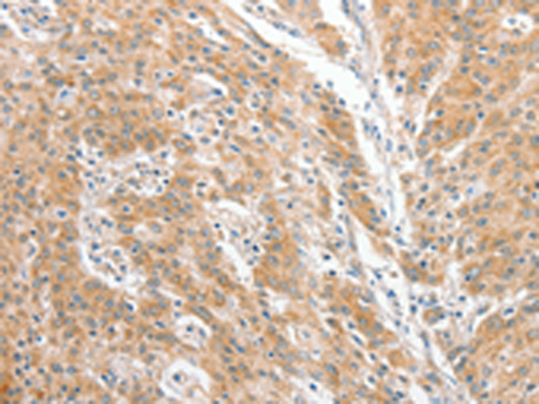 Anti-CERT Rabbit Polyclonal Antibody