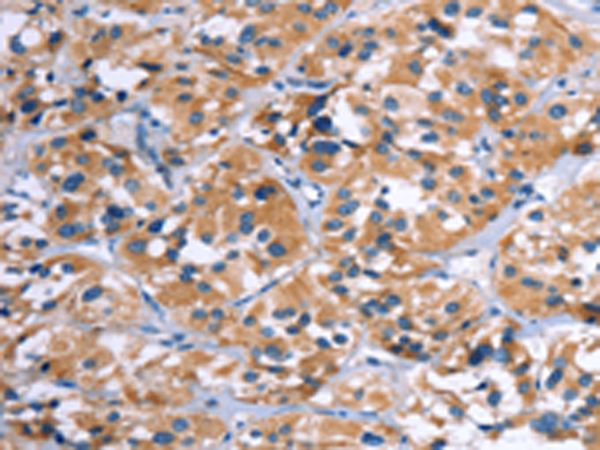 Anti-COMP Rabbit Polyclonal Antibody