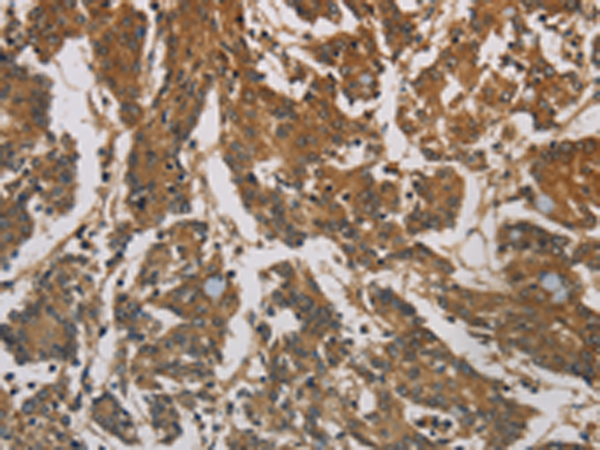 Anti-Coronin 3 Rabbit Polyclonal Antibody