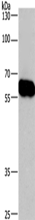 Anti-Coronin 3 Rabbit Polyclonal Antibody
