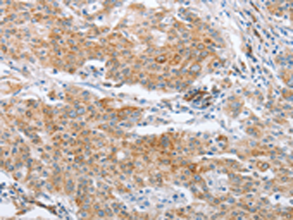 Anti-CRELD2 Rabbit Polyclonal Antibody