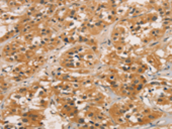 Anti-CTNNBIP1 Rabbit Polyclonal Antibody