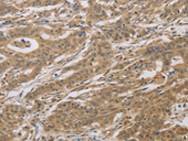 Anti-CYFIP2 Rabbit Polyclonal Antibody