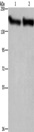 Anti-CYFIP2 Rabbit Polyclonal Antibody
