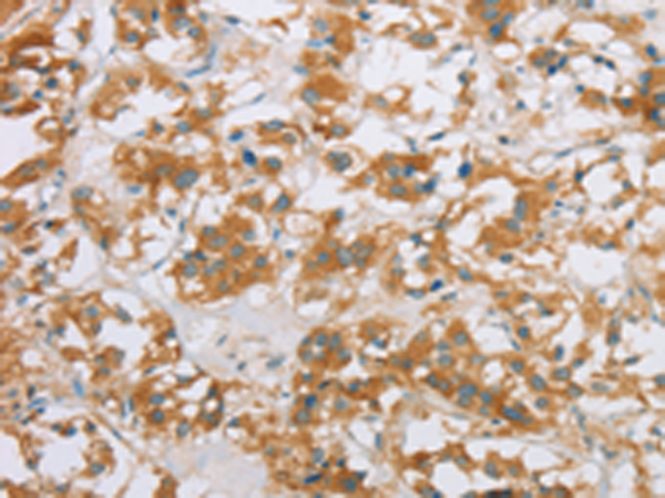 Anti-Cytochrome P450 2E1 Rabbit Polyclonal Antibody