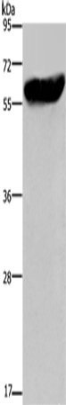 Anti-Cytochrome P450 2E1 Rabbit Polyclonal Antibody