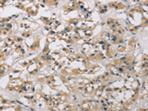 Anti-CCN1 Rabbit Polyclonal Antibody