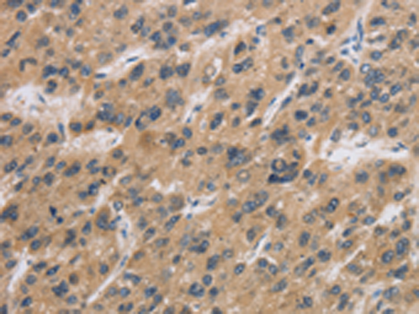 Anti-CST6 Rabbit Polyclonal Antibody