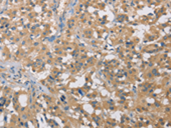 Anti-CST2 Rabbit Polyclonal Antibody