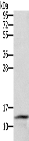 Anti-CST2 Rabbit Polyclonal Antibody