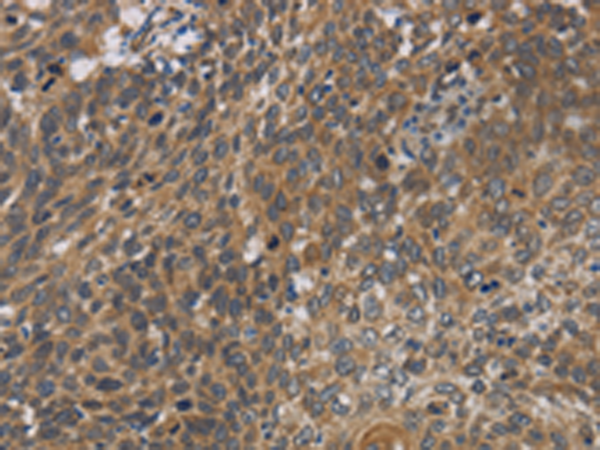 Anti-CYB5A Rabbit Polyclonal Antibody