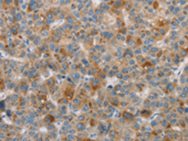 Anti-Dopamine beta Hydroxylase Rabbit Polyclonal Antibody
