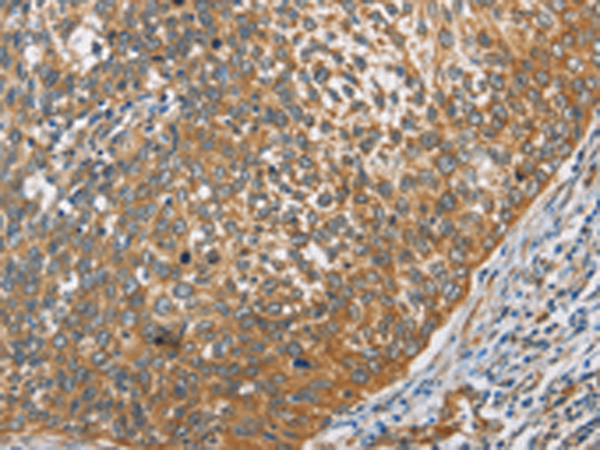Anti-Dynactin Subunit 2 Rabbit Polyclonal Antibody