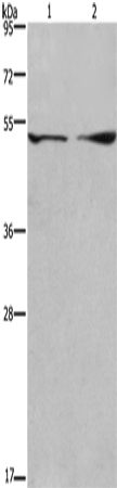 Anti-Dynactin Subunit 2 Rabbit Polyclonal Antibody