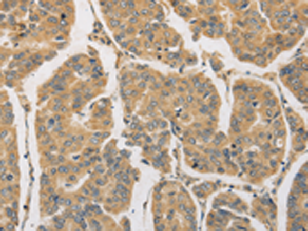 Anti-DDX19B Rabbit Polyclonal Antibody