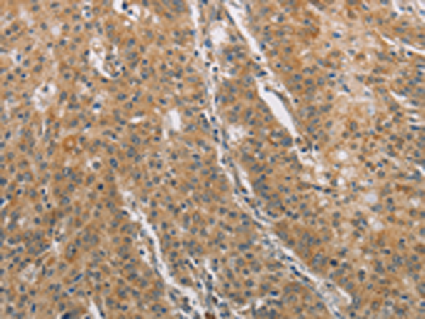 Anti-DDX53 Rabbit Polyclonal Antibody
