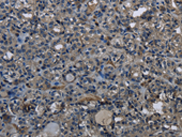 Anti-DHCR7 Rabbit Polyclonal Antibody