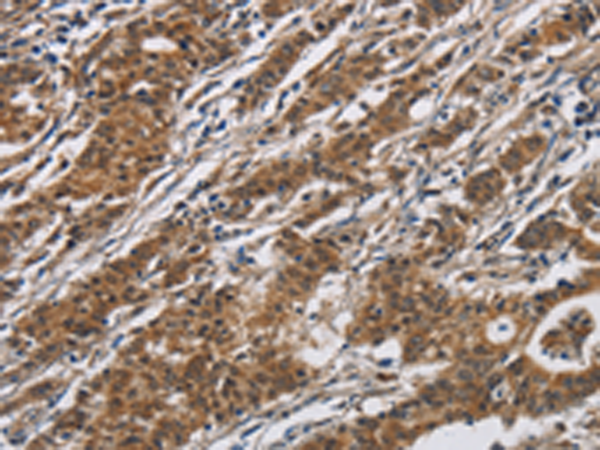 Anti-DHRS3 Rabbit Polyclonal Antibody