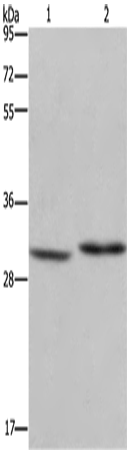 Anti-DHRS3 Rabbit Polyclonal Antibody