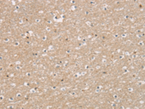 Anti-DMRT3 Rabbit Polyclonal Antibody