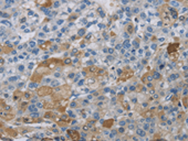 Anti-DNAJB4 Rabbit Polyclonal Antibody