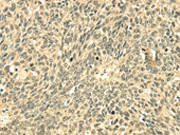 Anti-EEF1AKMT4 Rabbit Polyclonal Antibody