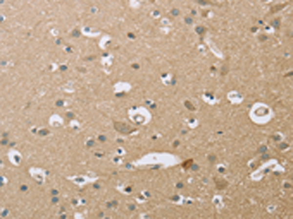 Anti-ECHS1 Rabbit Polyclonal Antibody
