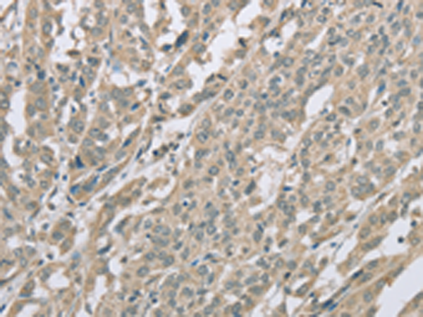 Anti-EDA2R Rabbit Polyclonal Antibody