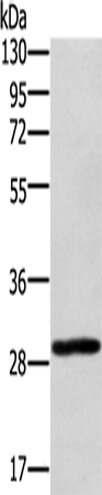 Anti-EDA2R Rabbit Polyclonal Antibody