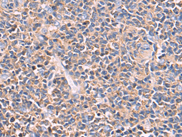 Anti-eIF3F Rabbit Polyclonal Antibody