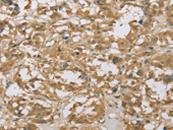Anti-eIF6 Rabbit Polyclonal Antibody