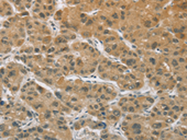 Anti-ELAC2 Rabbit Polyclonal Antibody