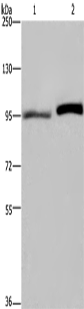Anti-ELAC2 Rabbit Polyclonal Antibody