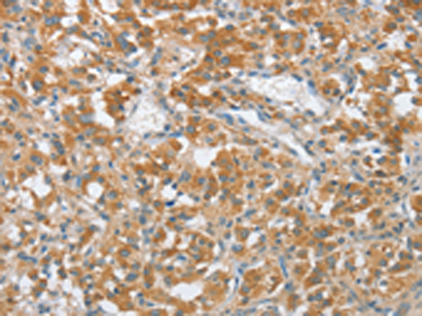 Anti-ENTPD5 Rabbit Polyclonal Antibody