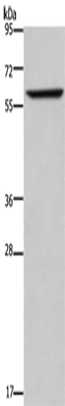 Anti-ENTPD5 Rabbit Polyclonal Antibody