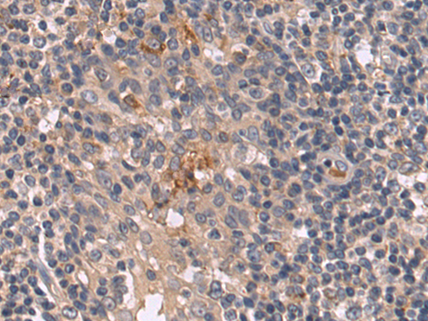 Anti-EPDR1 Rabbit Polyclonal Antibody