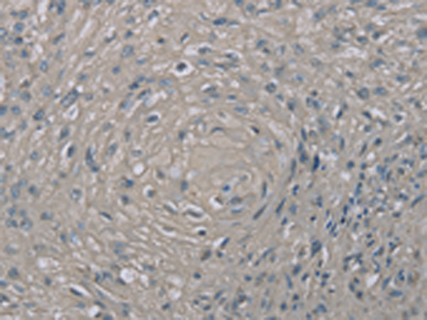 Anti-Endothelin 1 Rabbit Polyclonal Antibody