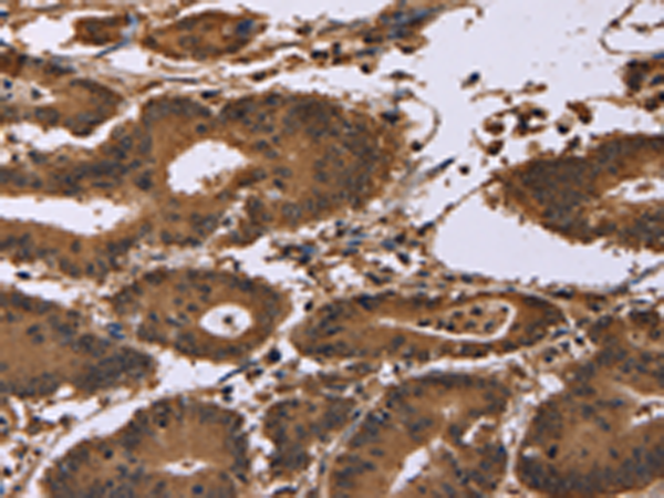 Anti-EDN2 Rabbit Polyclonal Antibody